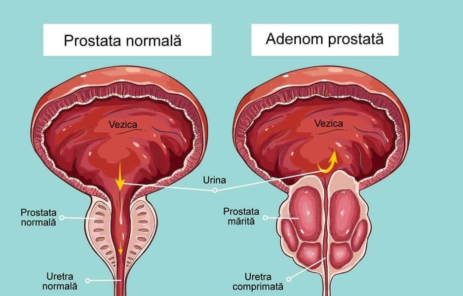 Ofer consultație gratuită .Specialist în medicina naturistă.