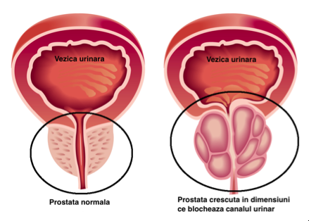 Ofer consultație gratuită.Specialist în medicina naturistă.