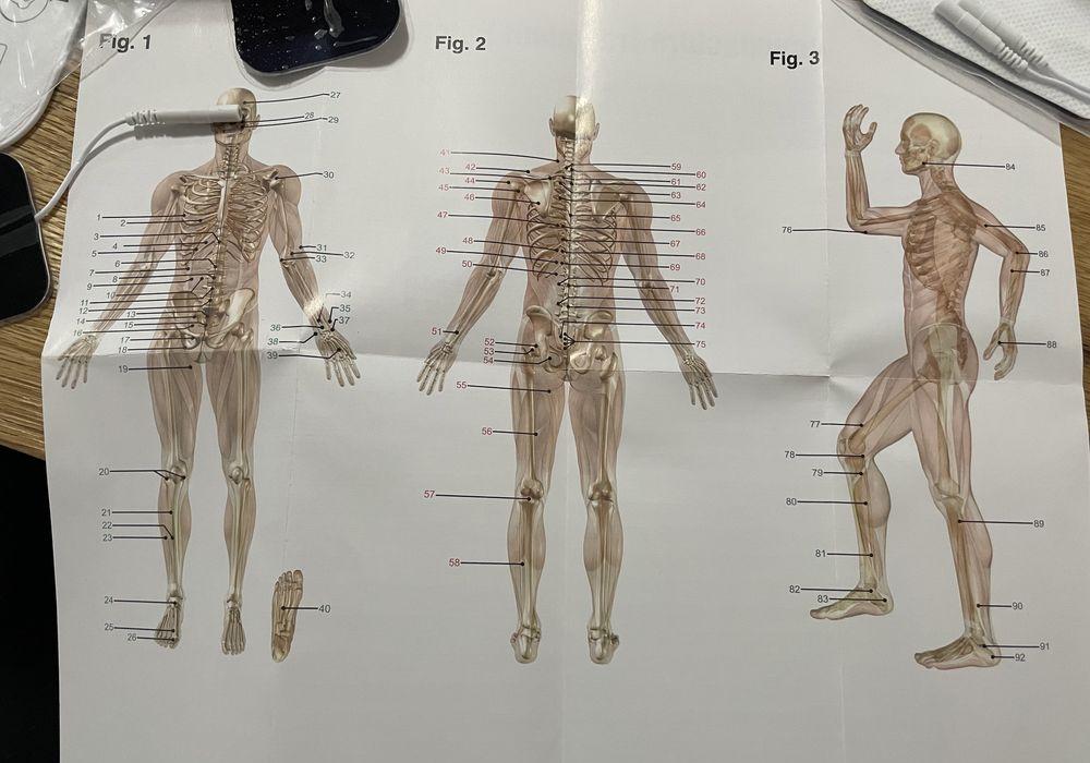 Electrostimulator nou pt. Calmarea Durerii acupunctura renpho sm9079