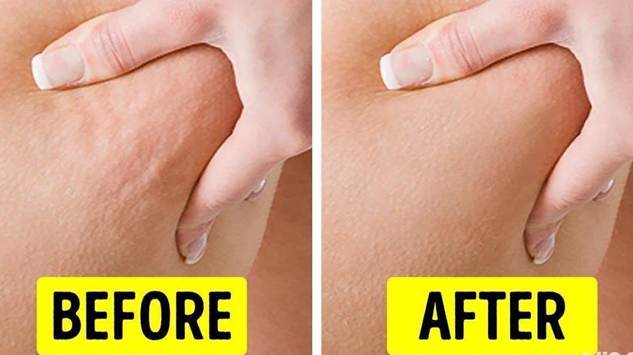 Masaj pt doamne. anticelulitic relaxare intretinere