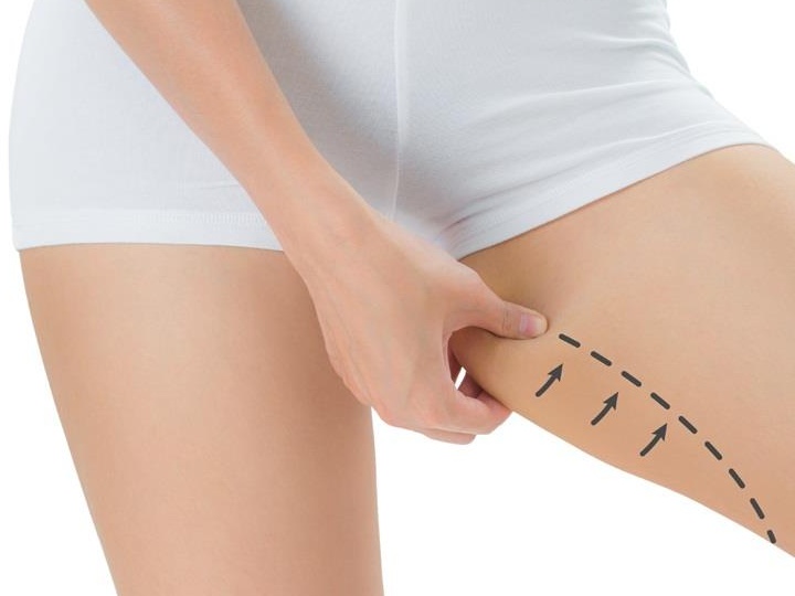 Masaj pt doamne. anticelulitic relaxare intretinere