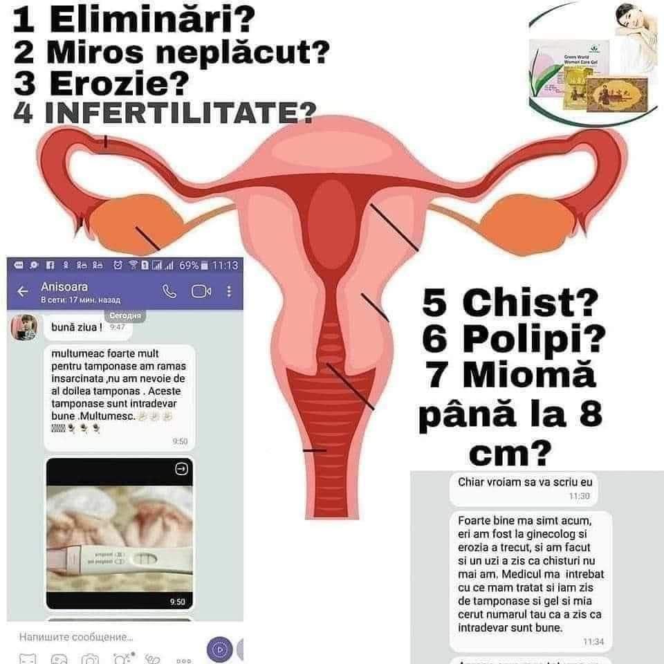 Ofer consultație gratuită