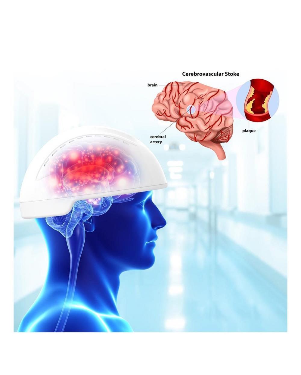 Prevenirea si Ameliorarea bolilor de cap