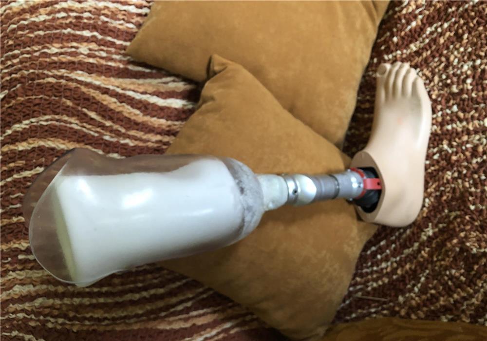 Proteza picior drept cu vacuum