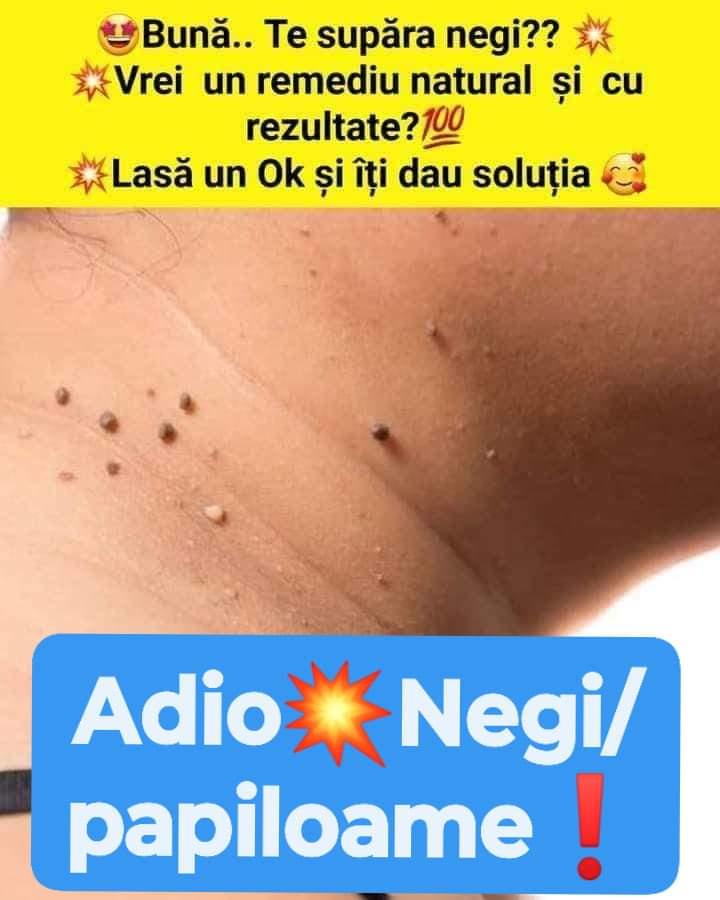 Stop micoza unghiilor
