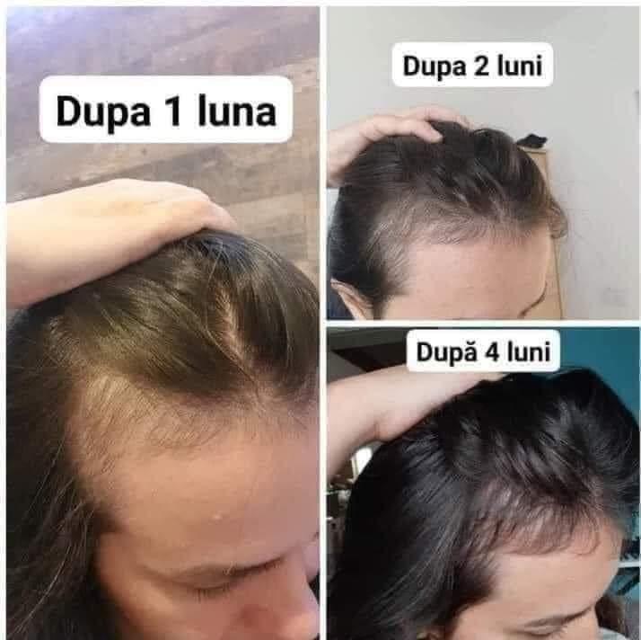Tratament pentru creșterea și regenerarea părului